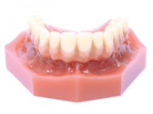 Semi Removable Acrylic Bridge Semi Removable Acrylic Bridge